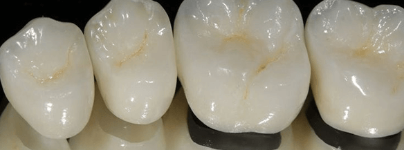 Научные исследования в области протезирования зубов п